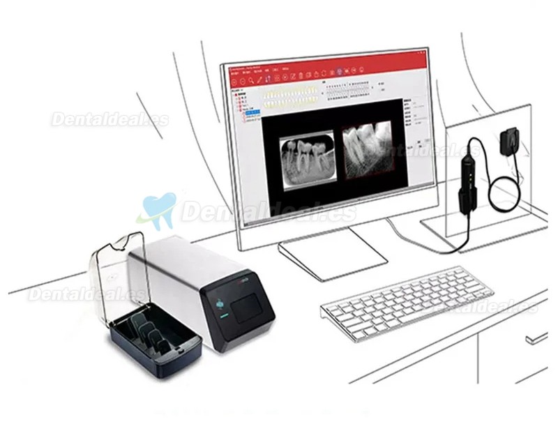 Handy HDS-500 Escáner de Placas Fotoestimulables de Odontología Escáner de Placas Fósforo